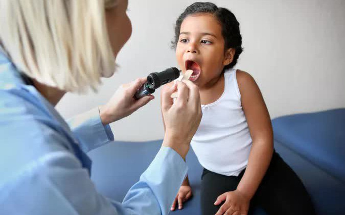 Chuyên gia hướng dẫn cách đối phó với đau họng ở trẻ