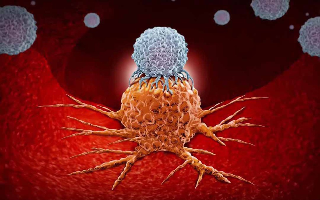 Liệu pháp miễn dịch trong điều trị ung thư: Hy vọng mới cho bệnh nhân mắc ung thư
