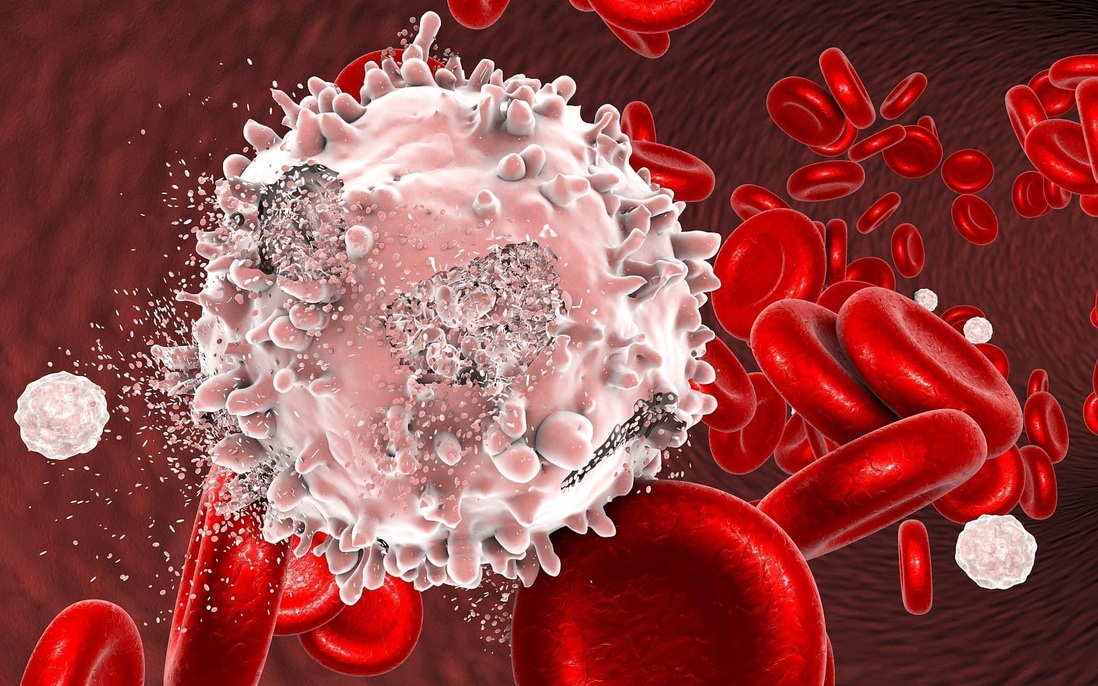 Bệnh ung thư máu có di truyền không?