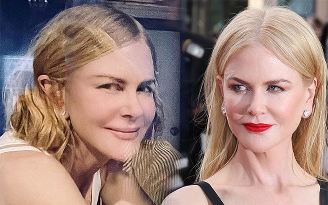 Nicole Kidman làm gì trên gương mặt không nếp nhăn ở tuổi U60?
