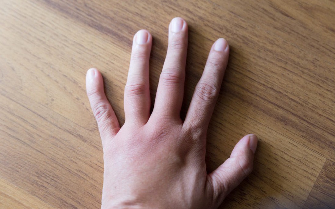 Khớp ngón tay bị sưng đau không chỉ do viêm khớp
