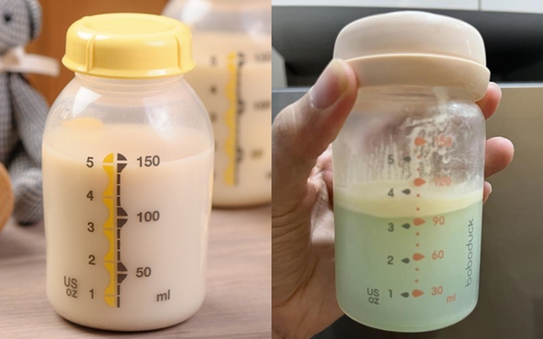 Sữa mẹ chuyển từ màu trắng sang màu xanh, bác sĩ giải thích lý do
