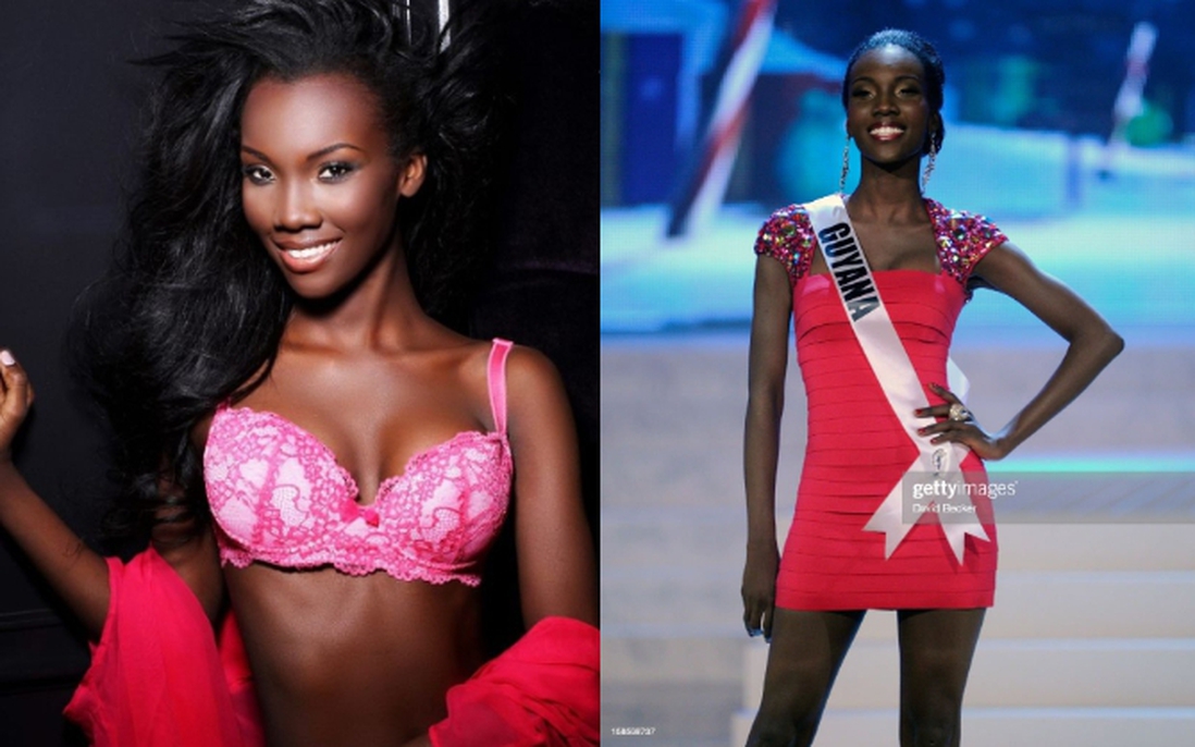 Hoa hậu Guyana 2012 mất tích khi đang điều trị bệnh