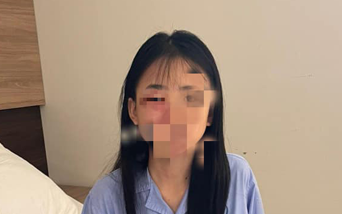 Đã xác định được nhóm học sinh đánh nữ sinh lớp 8 nhập viện ở Hà Nội