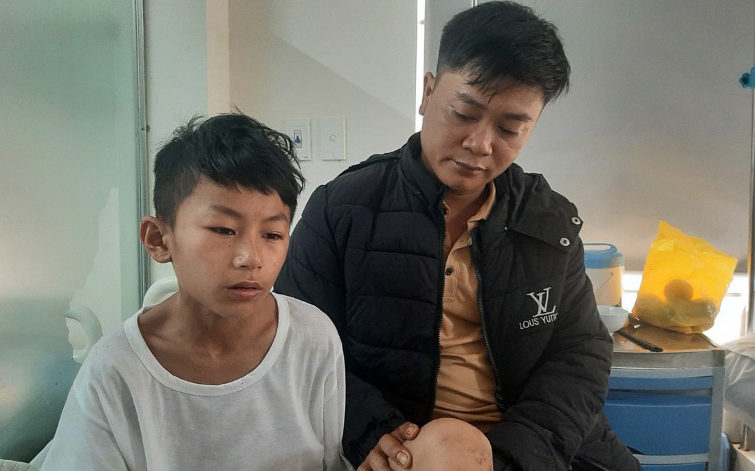 Vụ nổ gara kinh hoàng ở Nghệ An qua lời kể của bé trai 14 tuổi