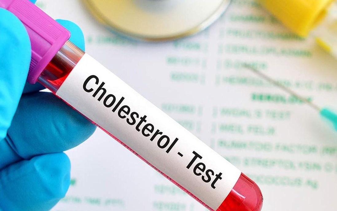 Cứ 10 người Việt trưởng thành thì có 3 người thừa cholesterol vì 1 nguyên nhân 