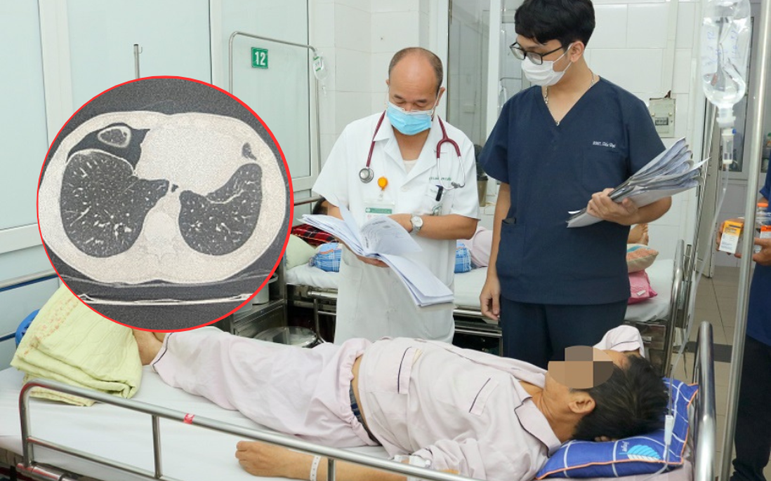 Nam thanh niên nhiễm “sán lá phổi”, nhập viện sau khi ăn gỏi