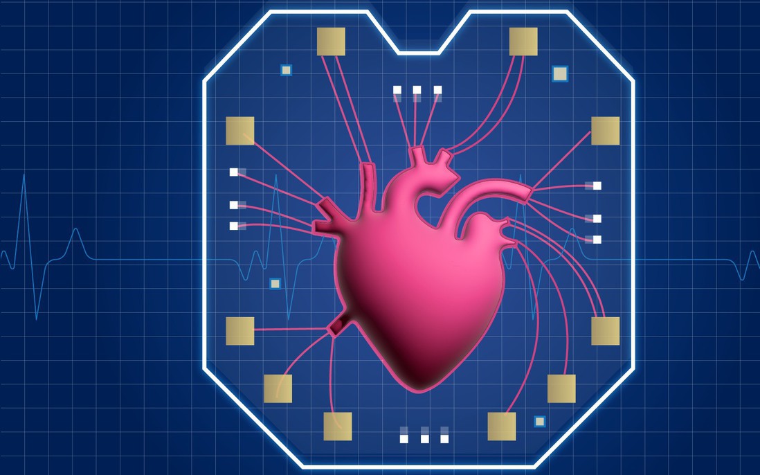 Trái tim nhân tạo trong con chip