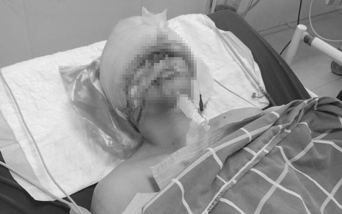 Vụ tai nạn giao thông ở Tuyên Quang: Diễn biến sức khoẻ của nạn nhân bị thương nặng nhất 