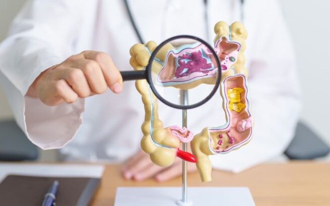 Phát triển máy in sinh học siêu nhỏ có thể chữa lành loét dạ dày