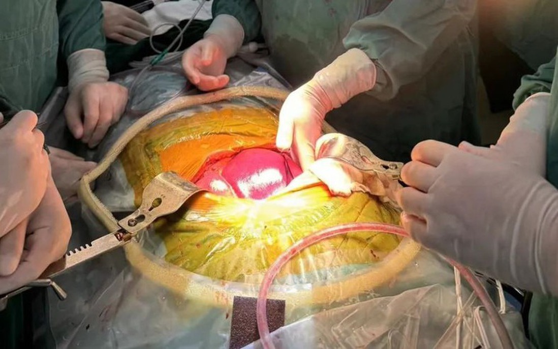 Trung Quốc thành công ghép gan lợn chỉnh sửa gene đầu tiên trên người sống