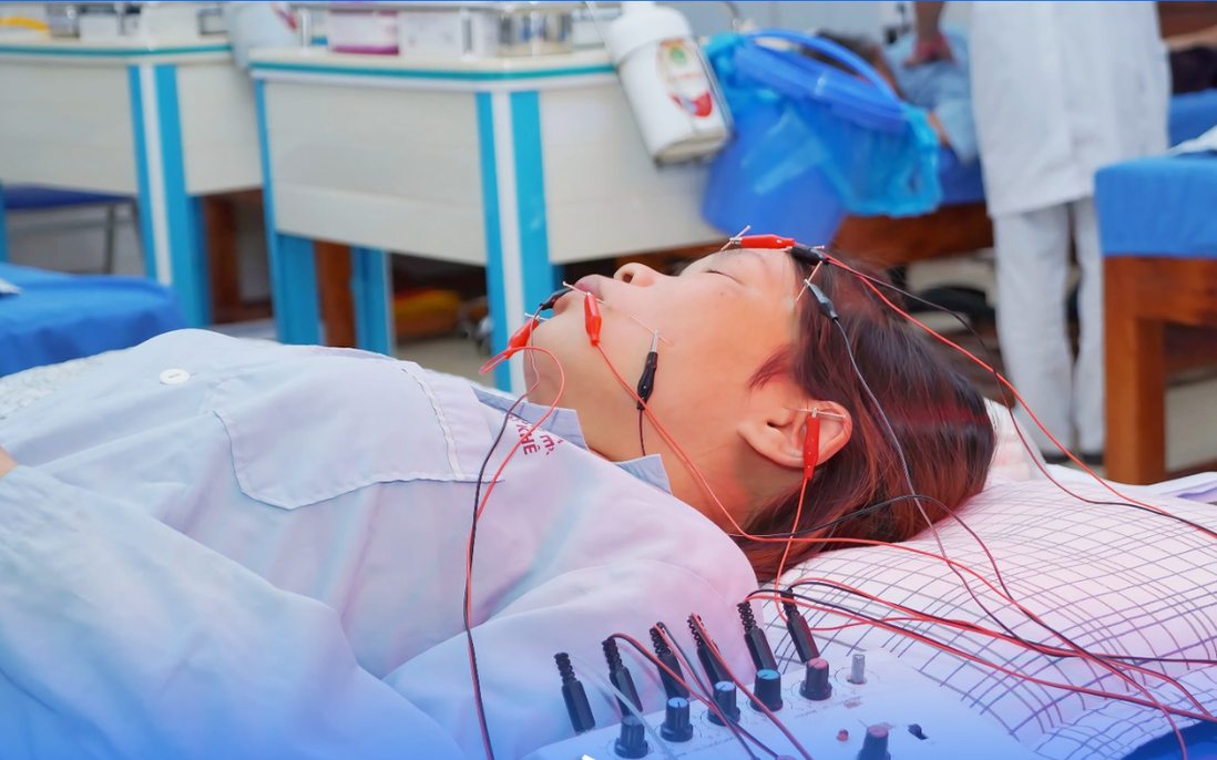 Nguy cơ méo miệng, liệt mặt khi thời tiết chuyển lạnh đột ngột