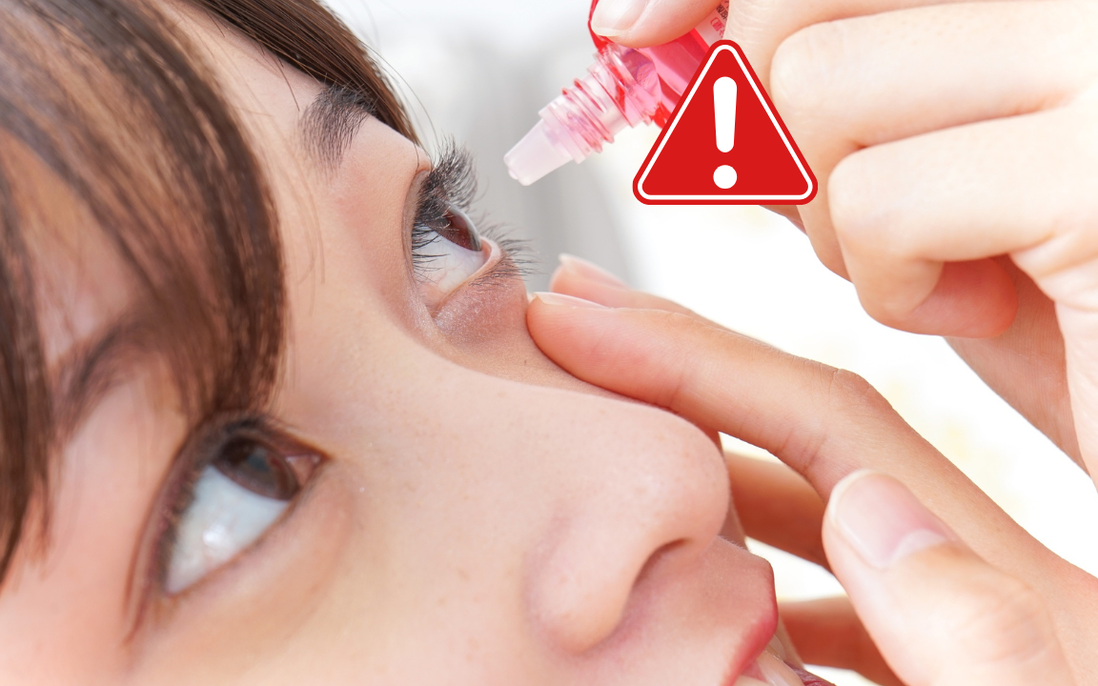 Mù lòa vĩnh viễn vì tự ý dùng thuốc nhỏ mắt suốt 2 năm