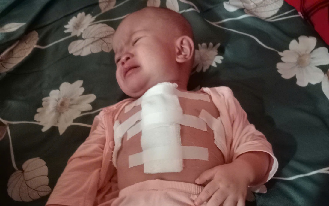 Gia cảnh thương tâm của bé gái mắc bệnh tim bẩm sinh ở Sơn La