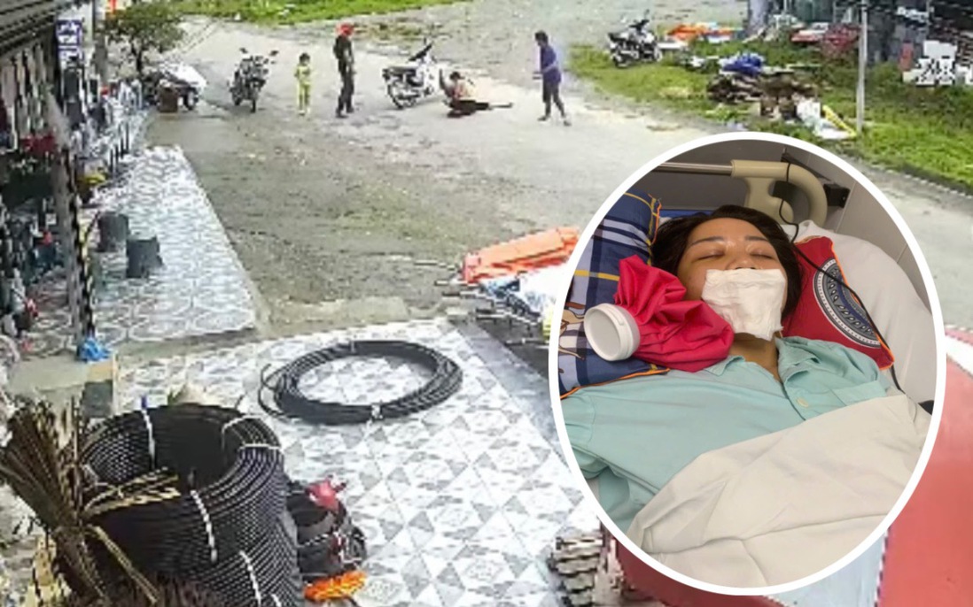 Vụ chó gây tai nạn ở Lào Cai: Trưởng Công an xã từng khẳng định xác định được chủ vật nuôi