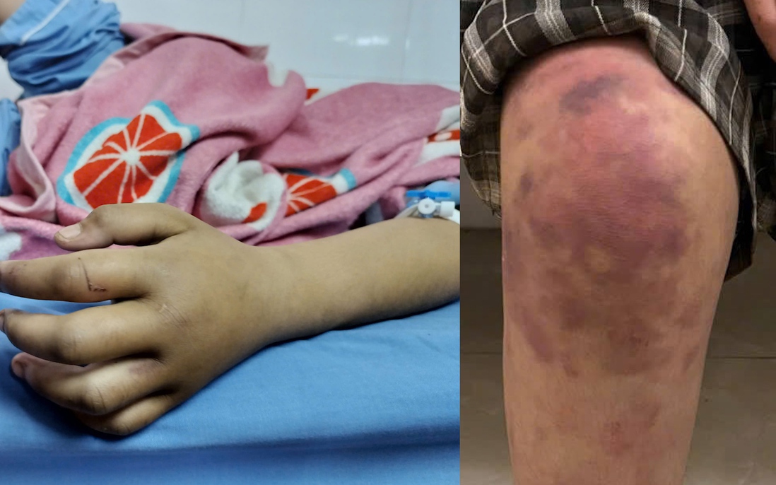 Bé gái 13 tuổi ở Thái Nguyên bị bạo hành: Lời nhắc nhở mạnh mẽ về trách nhiệm của chính quyền cơ sở