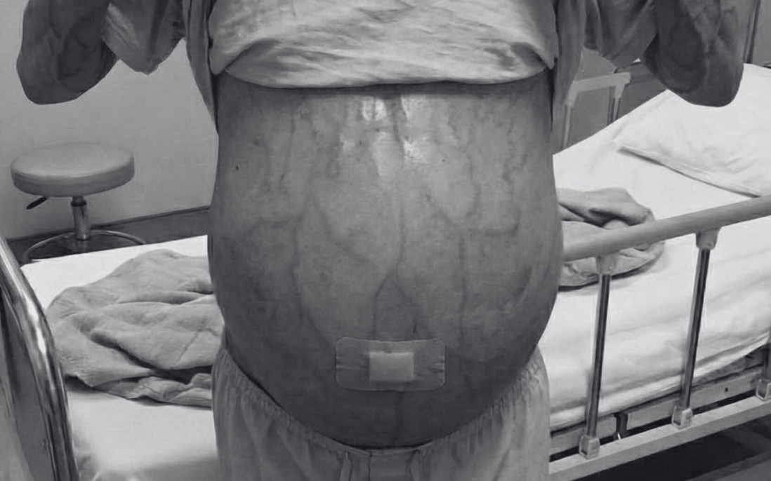 Hiểu lầm tai hại về ăn kiêng khiến nhiều người hoang mang