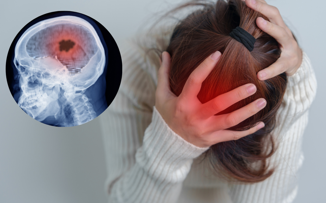 Phát hiện ung thư máu sau khi ngất lịm, đau đầu