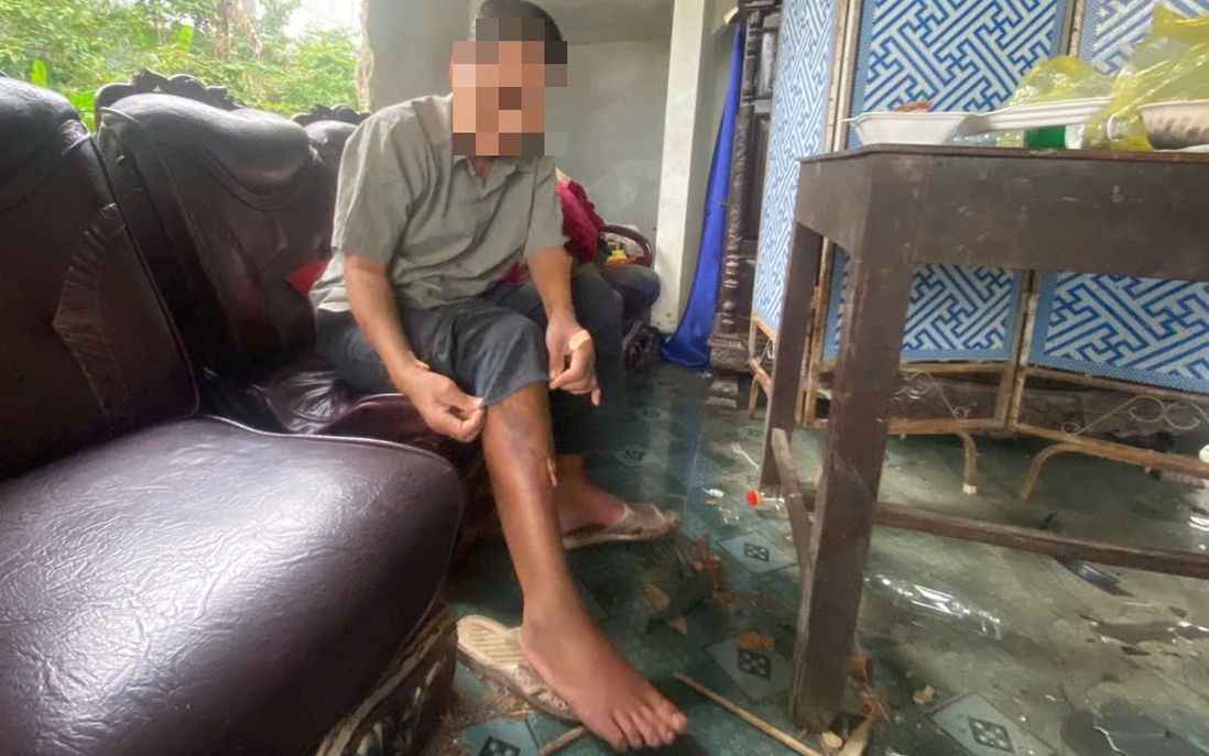 Huế: Nhóm thiếu niên nhiều lần hành hung vô cớ người đàn ông