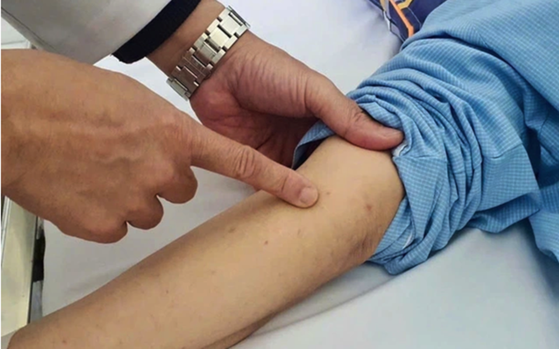 Chuyên gia khuyến nghị gì về bệnh truyền nhiễm có thể gây tử vong trong 24 giờ?