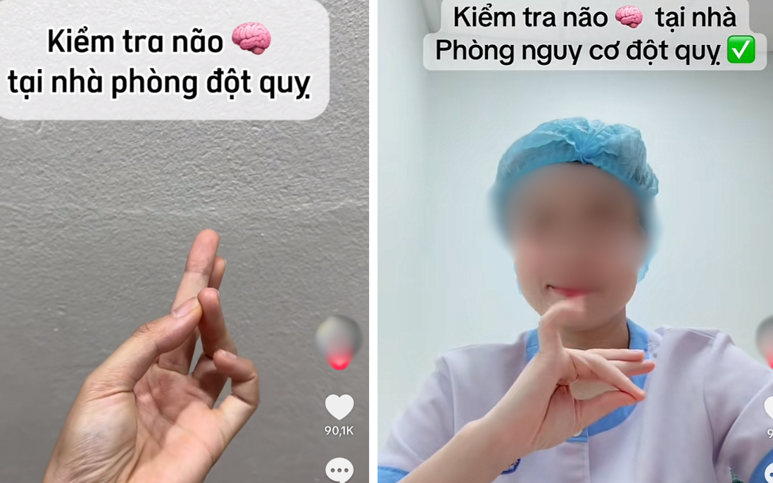 Chuyên gia cảnh báo nguy cơ việc kiểm tra đột quỵ bằng ngón tay