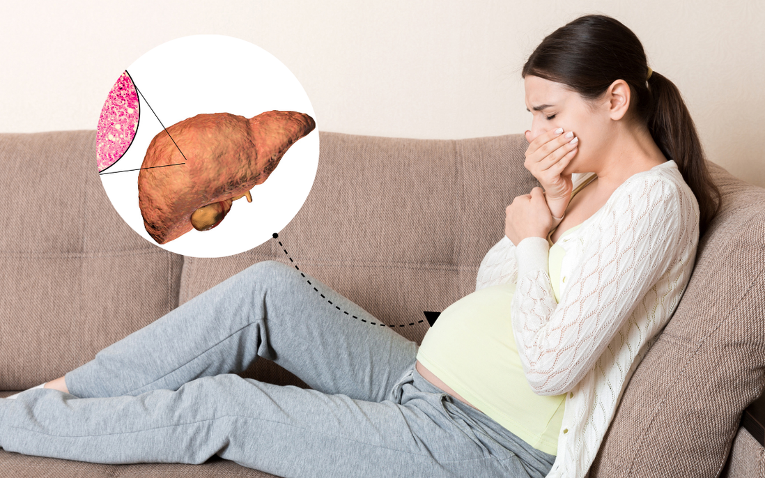 Mẹ bầu bị gan nhiễm mỡ ảnh hưởng đến thai nhi
