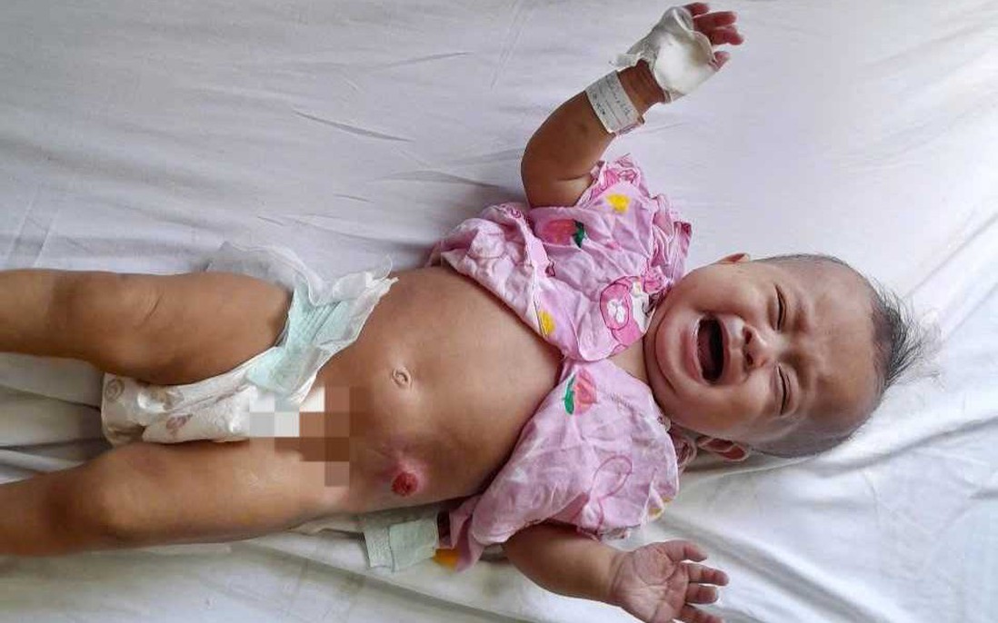 Ánh mắt cầu cứu của bé gái 6 tháng tuổi bị dị tật bẩm sinh, không tiền cứu chữa