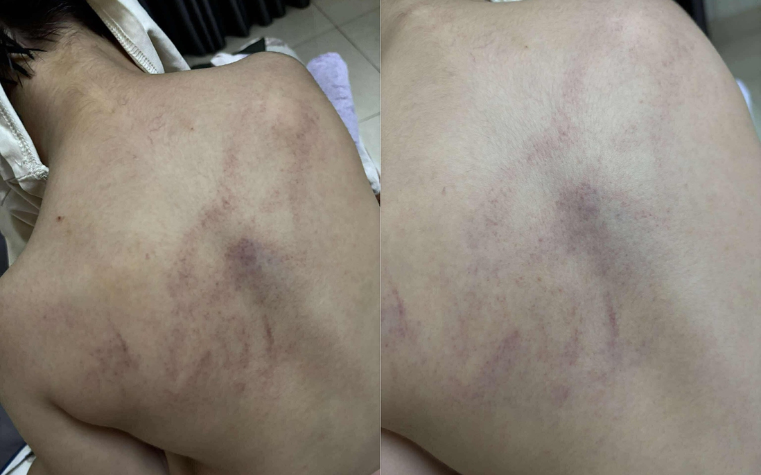 Vụ bé gái 4 tuổi bị đánh, ném vào tường: Cục Bà mẹ và Trẻ em đề nghị xử lý nghiêm