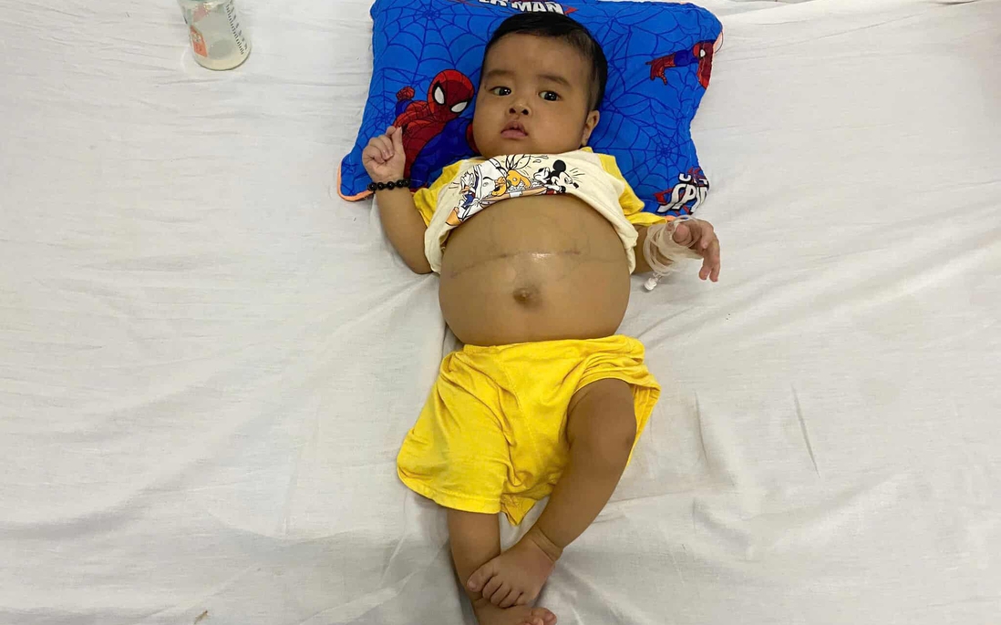 Ánh mắt cầu cứu của bé trai 7 tháng tuổi bụng to bất thường vì bệnh hiểm nghèo