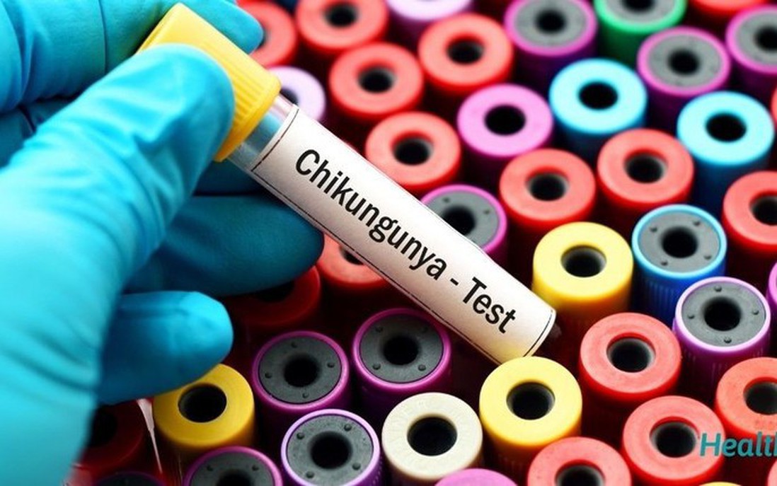 Không nên tự ý điều trị khi có dấu hiệu mắc Chikungunya 