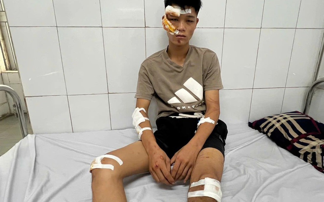 Quái xế "thông chốt" tông vào Cảnh sát cơ động có thể lĩnh án tới 20 năm tù?