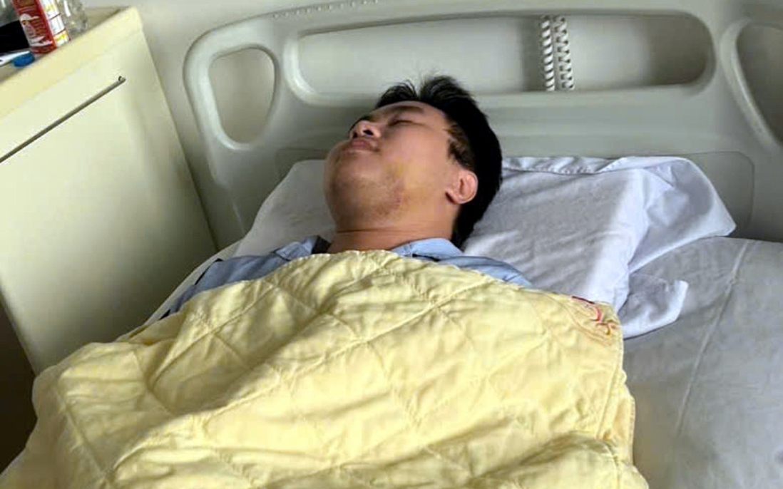 Xác minh thông tin nam sinh viên bị đánh gãy xương hàm vì bị cho là "nhìn đểu"