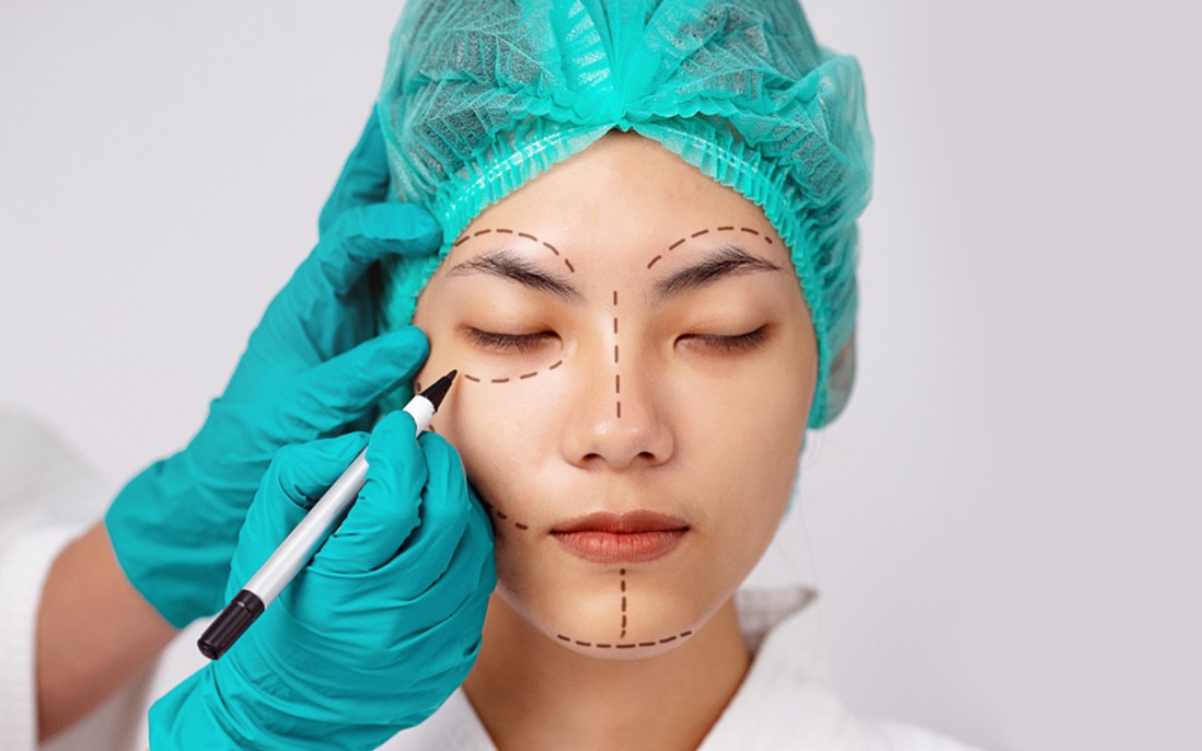 "Em nên đi phẫu thuật thẩm mỹ!" - Lời khuyên của bạn trai khiến tôi chết lặng