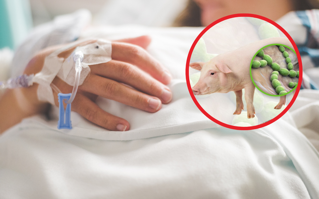Ăn tiết canh lợn, người đàn ông nhập viện vì viêm màng não mủ