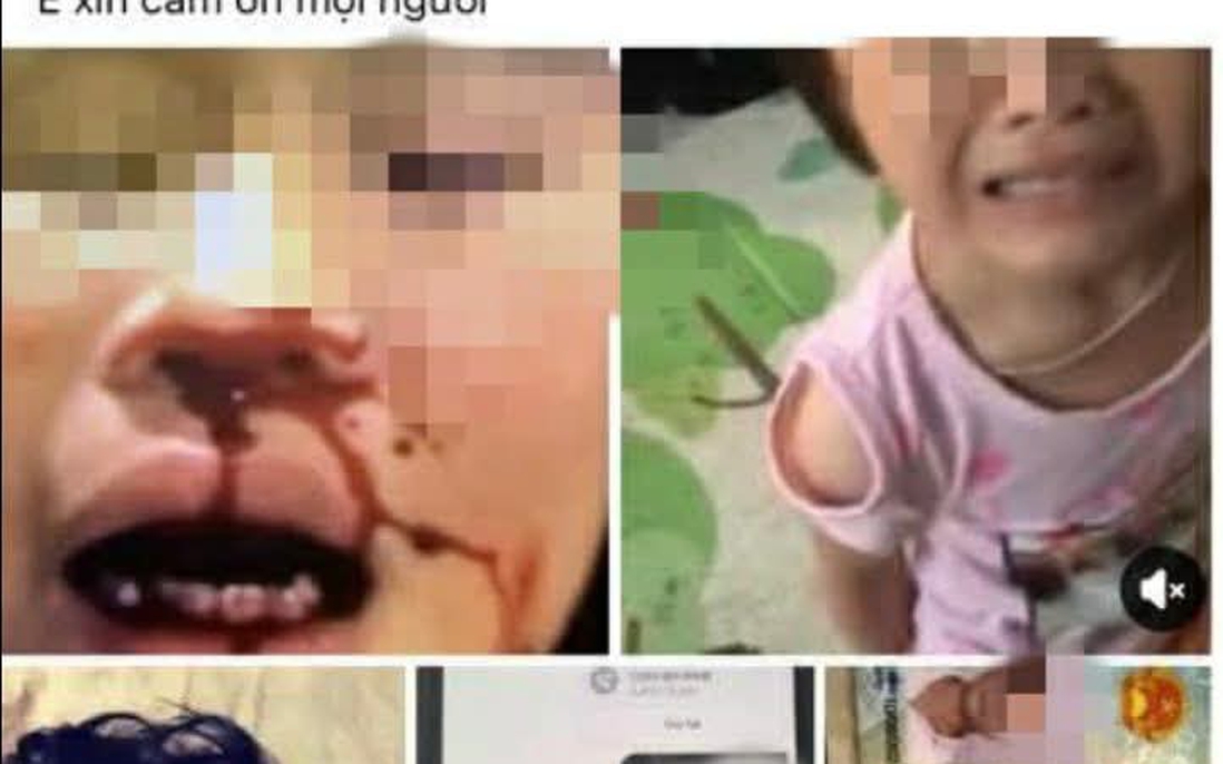 Vụ bé gái nghi bị bố bạo hành, bắt gọi mẹ "gửi tiền về": Kết quả xác minh từ chính quyền