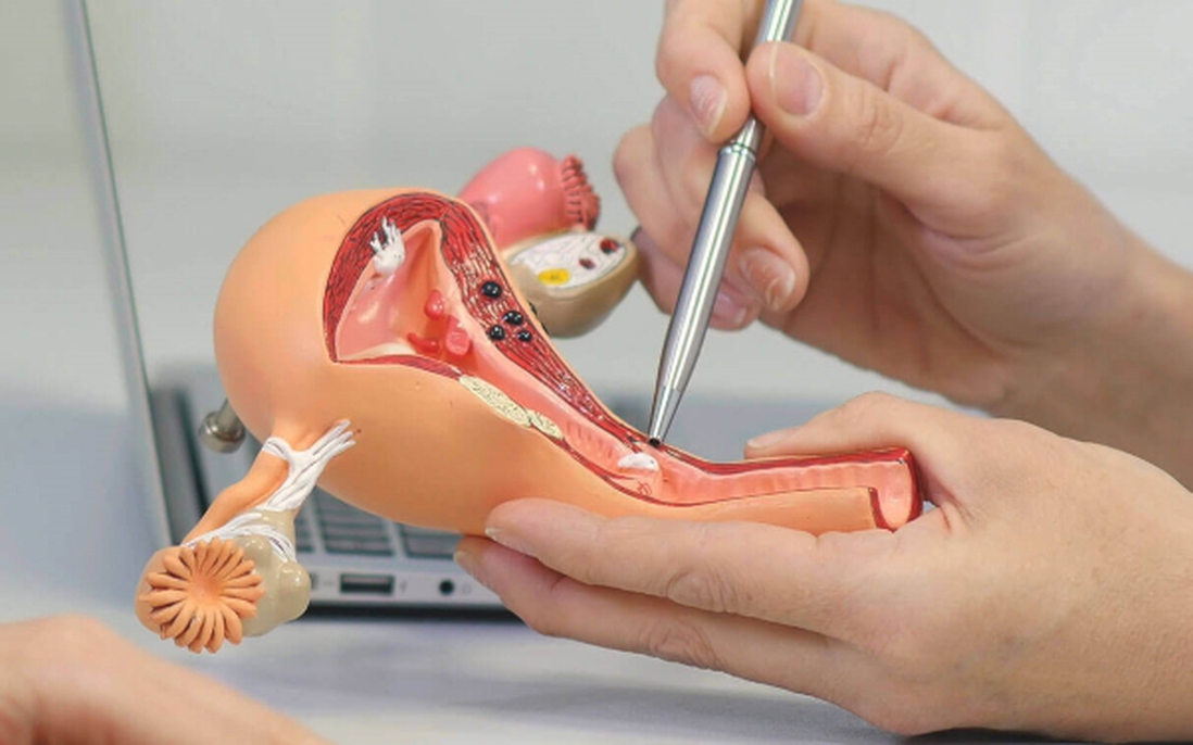 Bác sĩ thắt ống dẫn trứng nhưng không tư vấn cho bệnh nhân