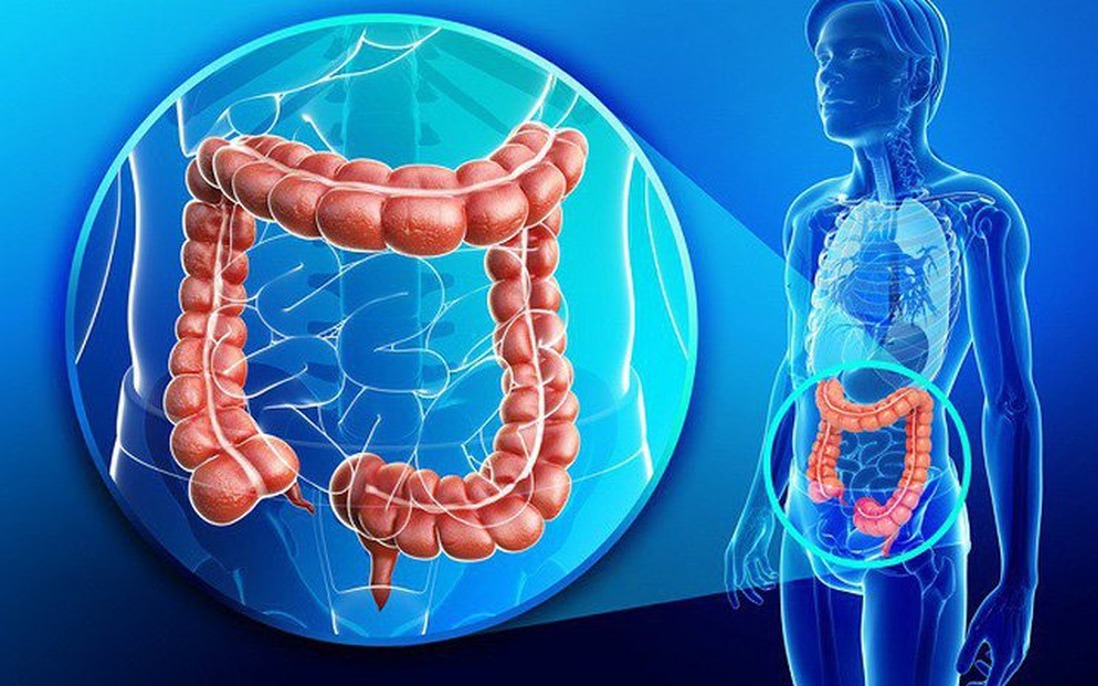 Ung thư đại tràng trở thành nguyên nhân hàng đầu gây tử vong do ung thư ở người dưới 50 tuổi tại Mỹ