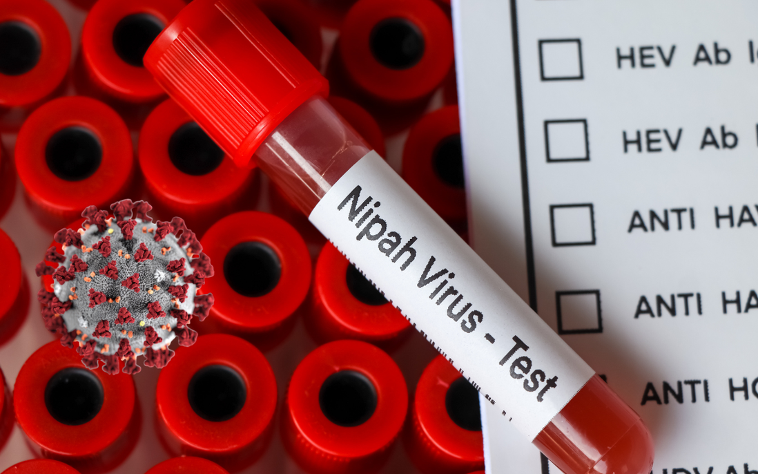 Siết chặt “tuyến phòng thủ” an toàn thực phẩm để ngăn chặn virus Nipah xâm nhập