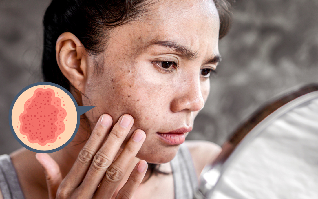 Bác sĩ da liễu lý giải vì sao da mãi không đẹp dù chăm sóc kỹ