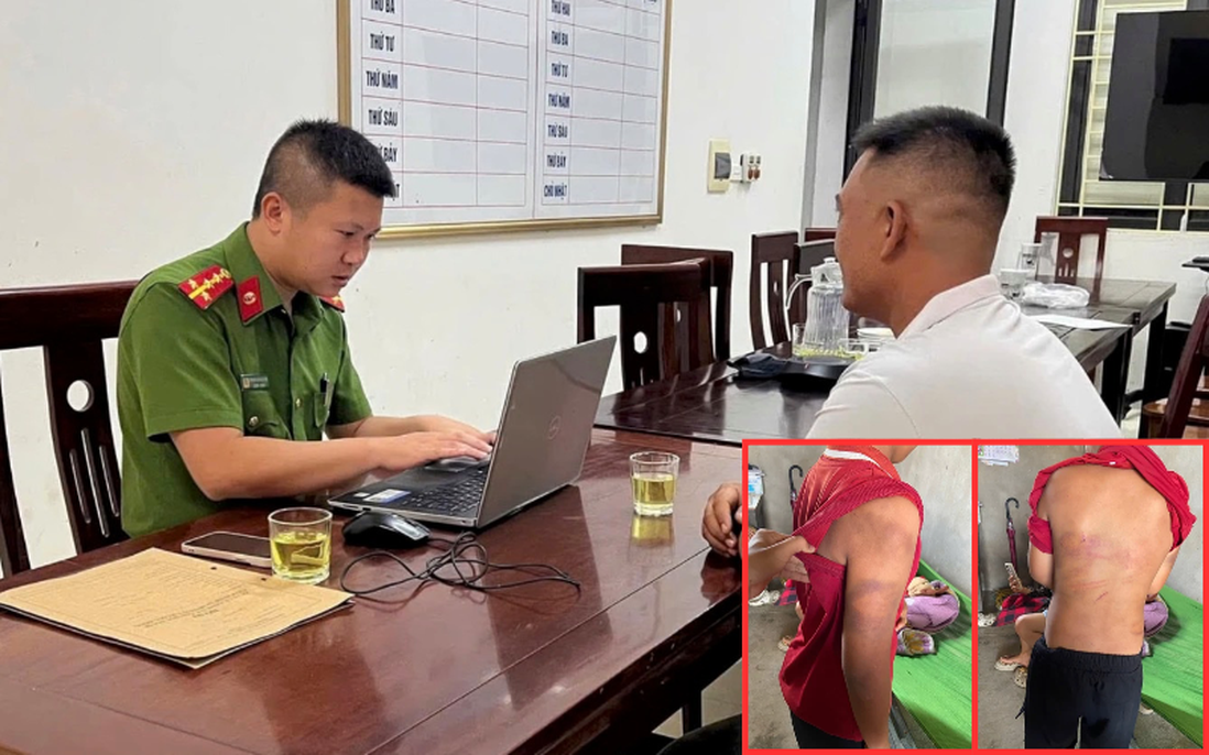 Vụ bé trai 10 tuổi bị bạo hành ở Nghệ An: Người cha sắp hầu tòa