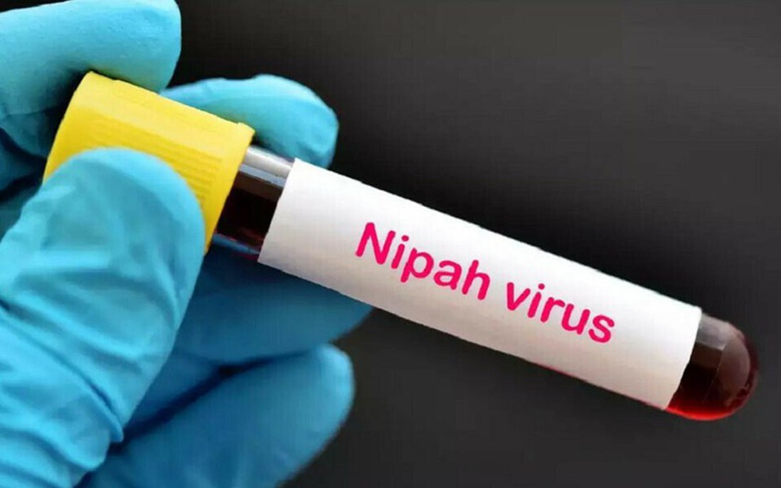 Bộ Y tế hướng dẫn chẩn đoán và điều trị bệnh do virus Nipah