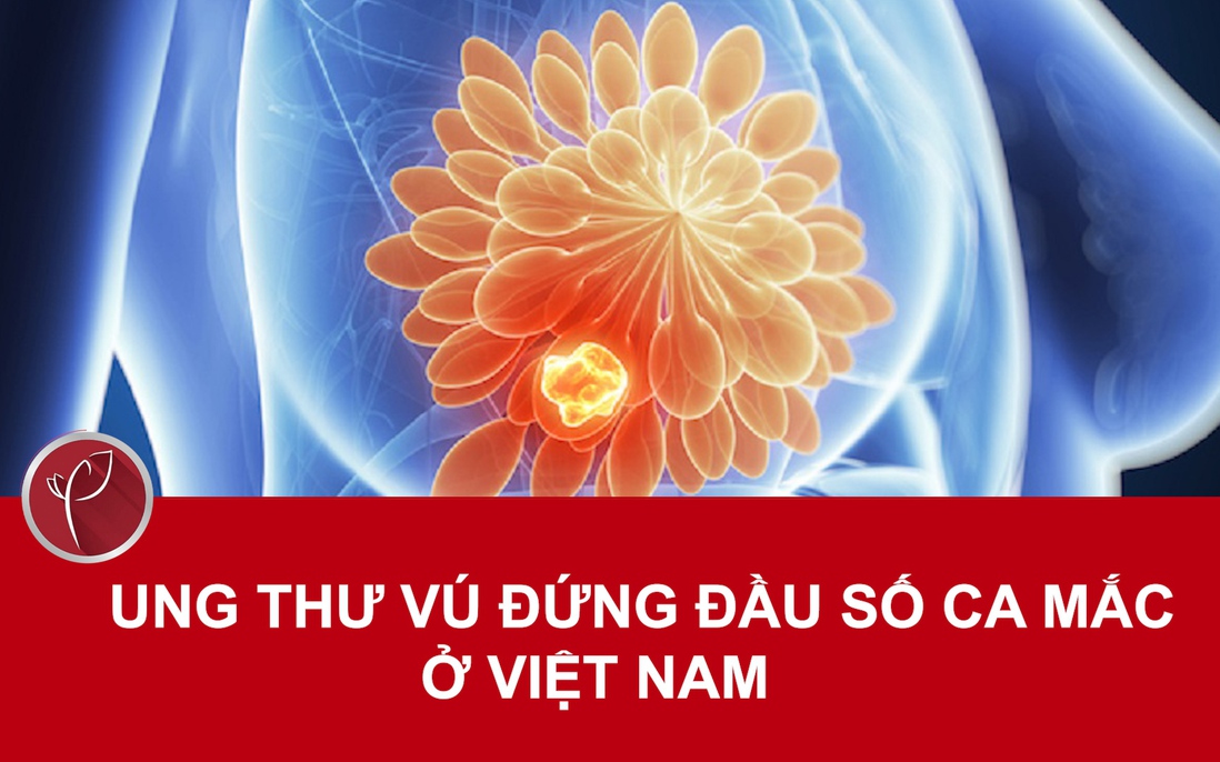 Ung thư vú đứng đầu số ca mắc ung thư ở Việt Nam