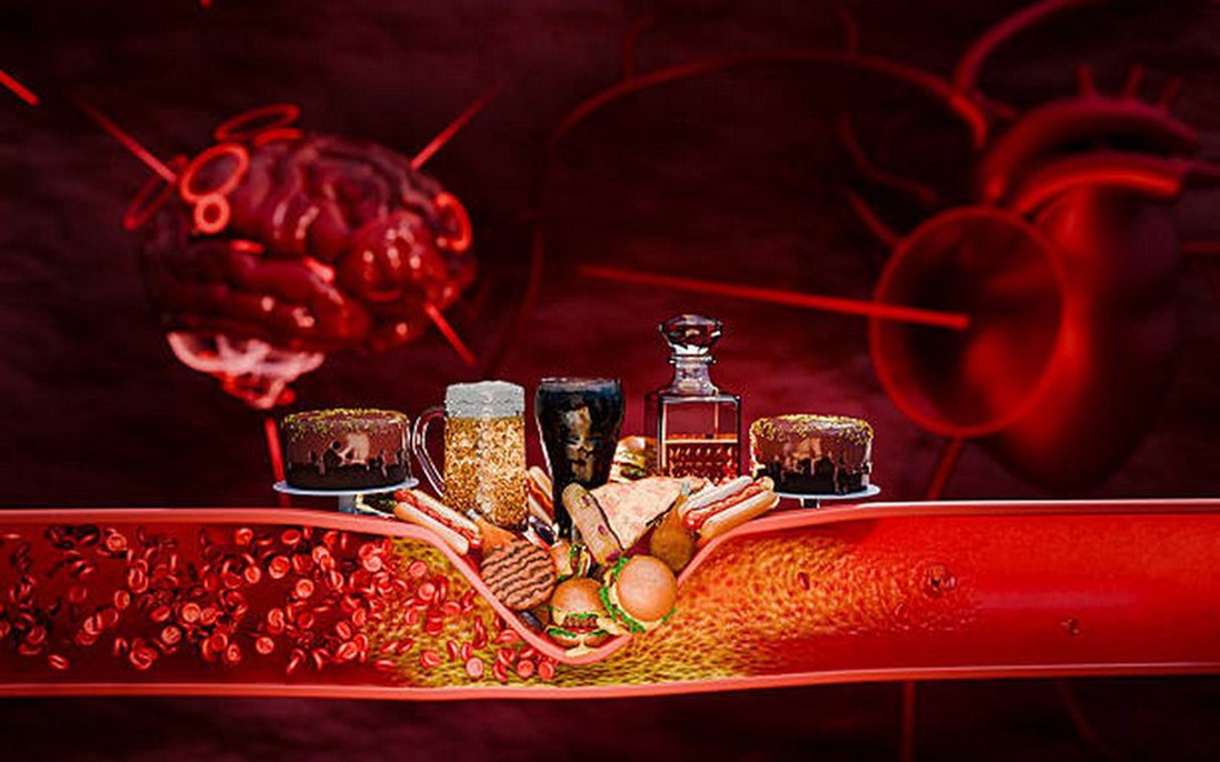 Những loại thực phẩm cần tránh nếu bạn có cholesterol cao