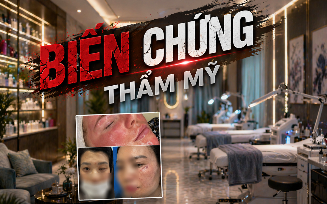 Thẩm mỹ tăng trưởng nóng: Cảnh báo từ các ca biến chứng