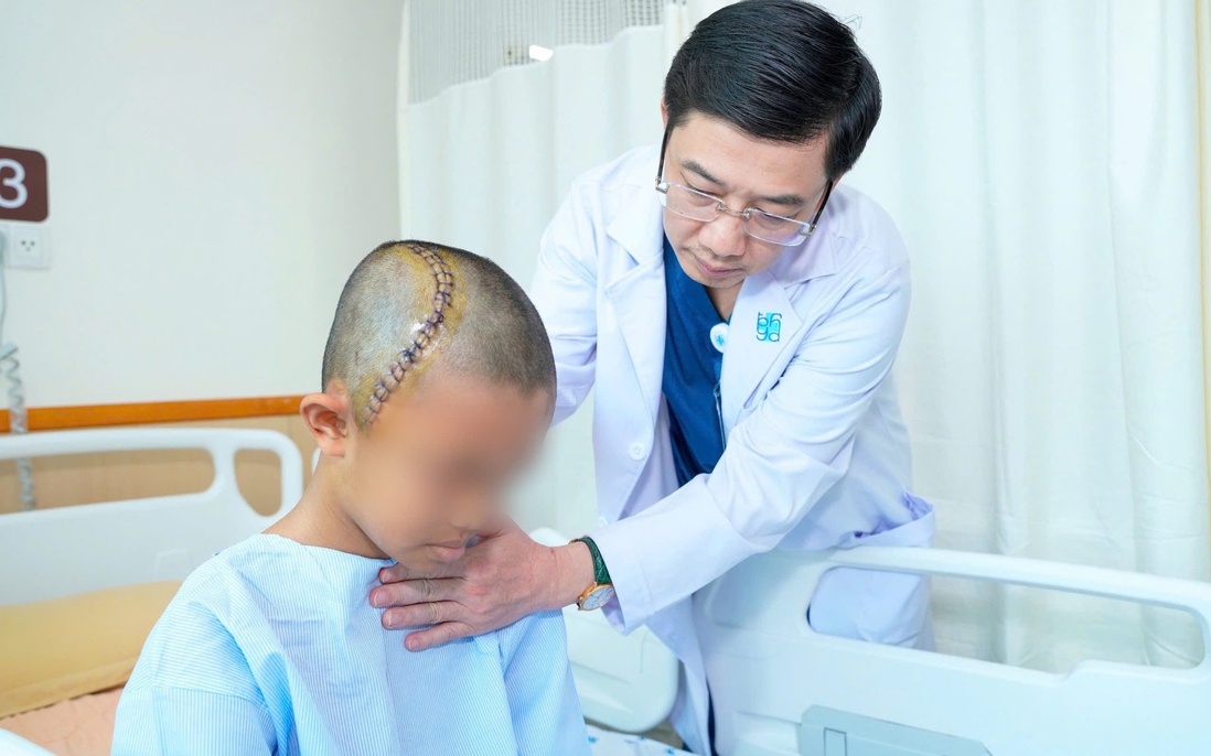 Áp dụng kỹ thuật mổ sọ thức tỉnh cho bé trai 12 tuổi bị u não