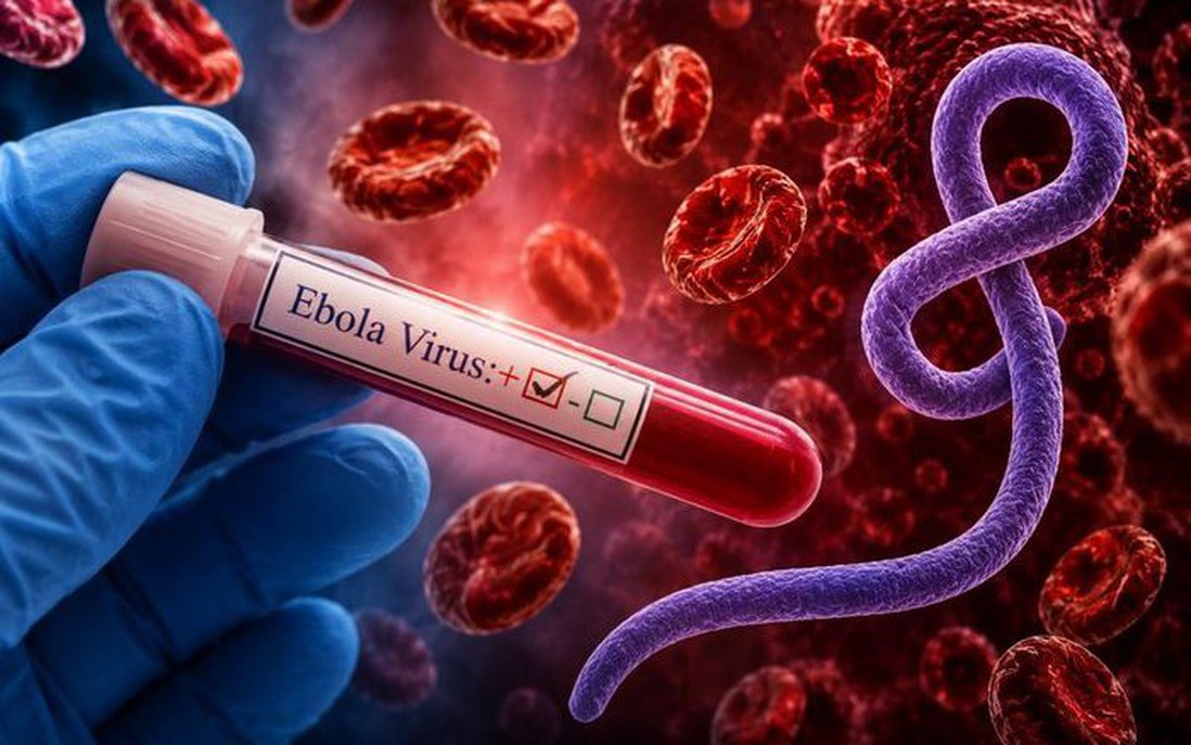 Bộ Y tế kích hoạt các biện pháp ứng phó nguy cơ Ebola xâm nhập Việt Nam