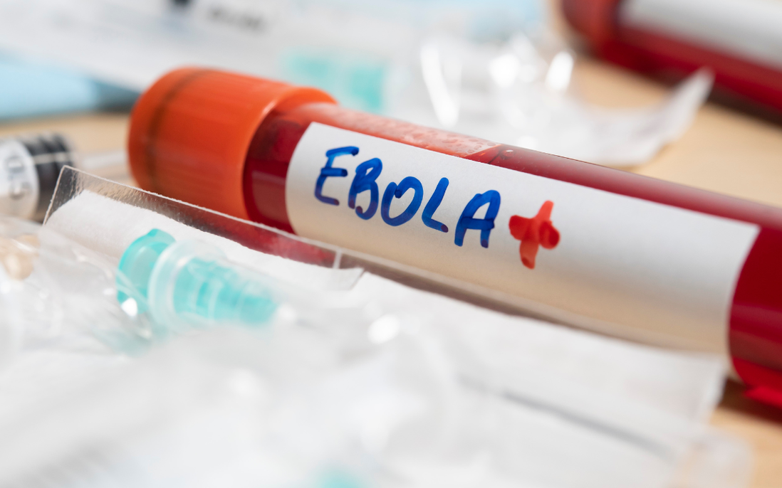 Bộ Y tế yêu cầu chủ động phòng chống bệnh do vi rút Ebola