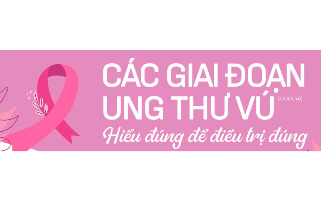 Ung thư vú: Hiểu đúng về các giai đoạn bệnh