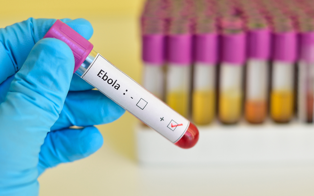 Nguyên tắc "2 - 5 - 30" ngăn Ebola lây lan