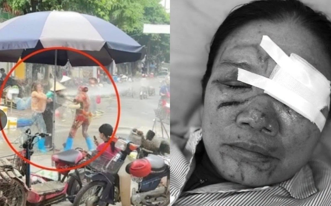 Khởi tố phụ nữ bán hải sản dùng vòi rửa xe xịt người bán rau gây thương tích